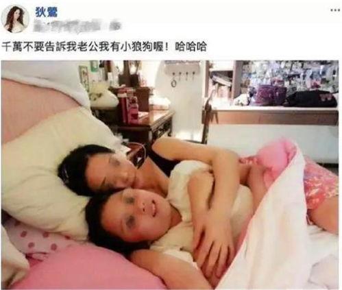 明星畸形孩子,畸形孩子的背后故事